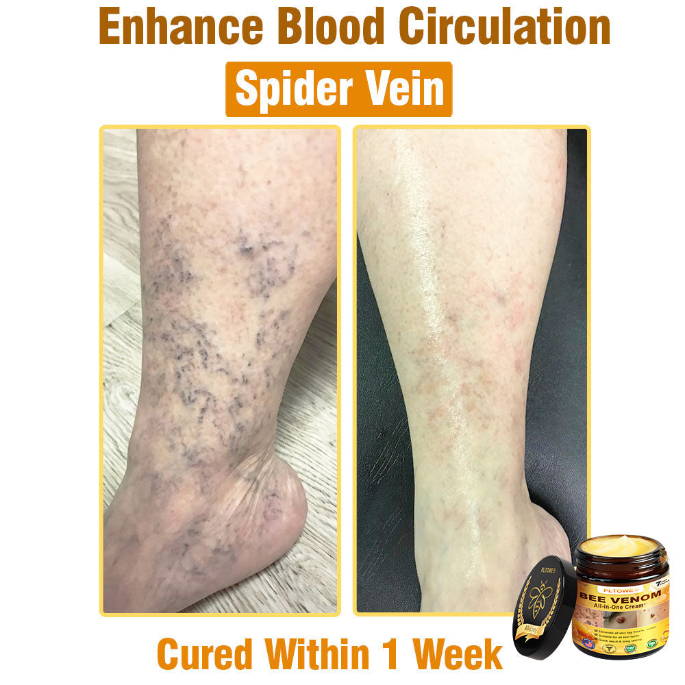 Only 5 jars! Grab an exclusive 50% discount now! Keep your skin youthful and glowing in just 1 to 4 weeks. Donāt miss your chanceāthis offer wonāt come around again until next year. Act fast! 180-day money back guarantee!
