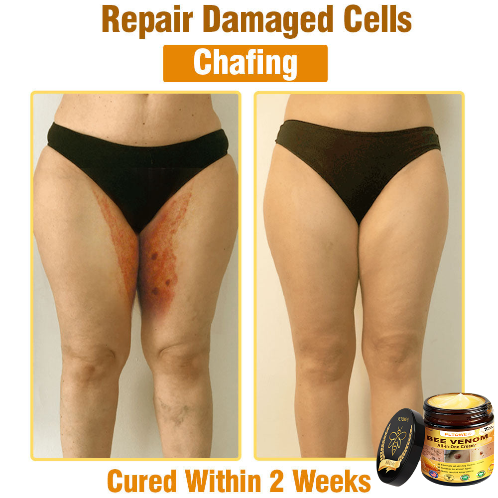 Only 5 jars! Grab an exclusive 50% discount now! Keep your skin youthful and glowing in just 1 to 4 weeks. Donāt miss your chanceāthis offer wonāt come around again until next year. Act fast! 180-day money back guarantee!