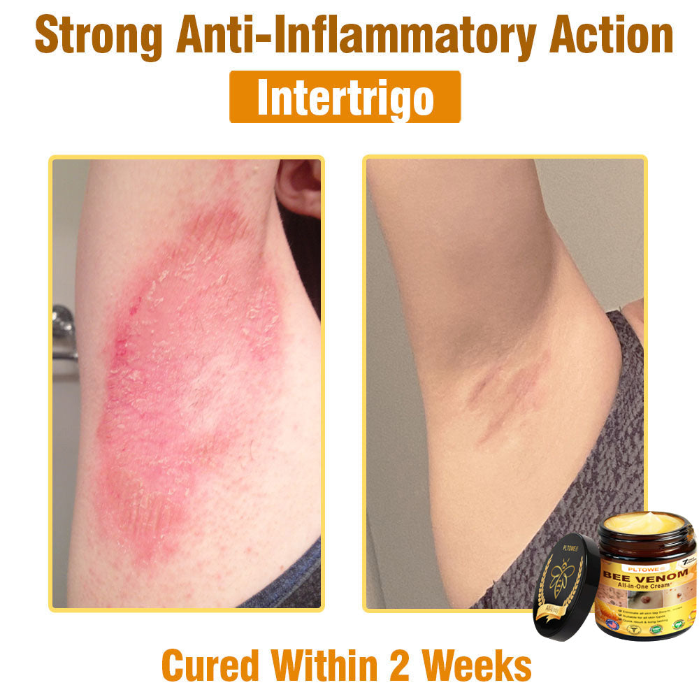 Only 5 jars! Grab an exclusive 50% discount now! Keep your skin youthful and glowing in just 1 to 4 weeks. Don’t miss your chance—this offer won’t come around again until next year. Act fast! 180-day money back guarantee!
