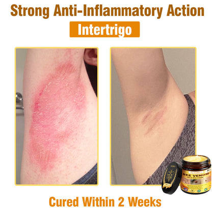 Only 5 jars! Grab an exclusive 50% discount now! Keep your skin youthful and glowing in just 1 to 4 weeks. Don’t miss your chance—this offer won’t come around again until next year. Act fast! 180-day money back guarantee!