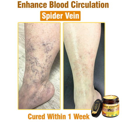 Only 5 jars! Grab an exclusive 50% discount now! Keep your skin youthful and glowing in just 1 to 4 weeks. Don’t miss your chance—this offer won’t come around again until next year. Act fast! 180-day money back guarantee!