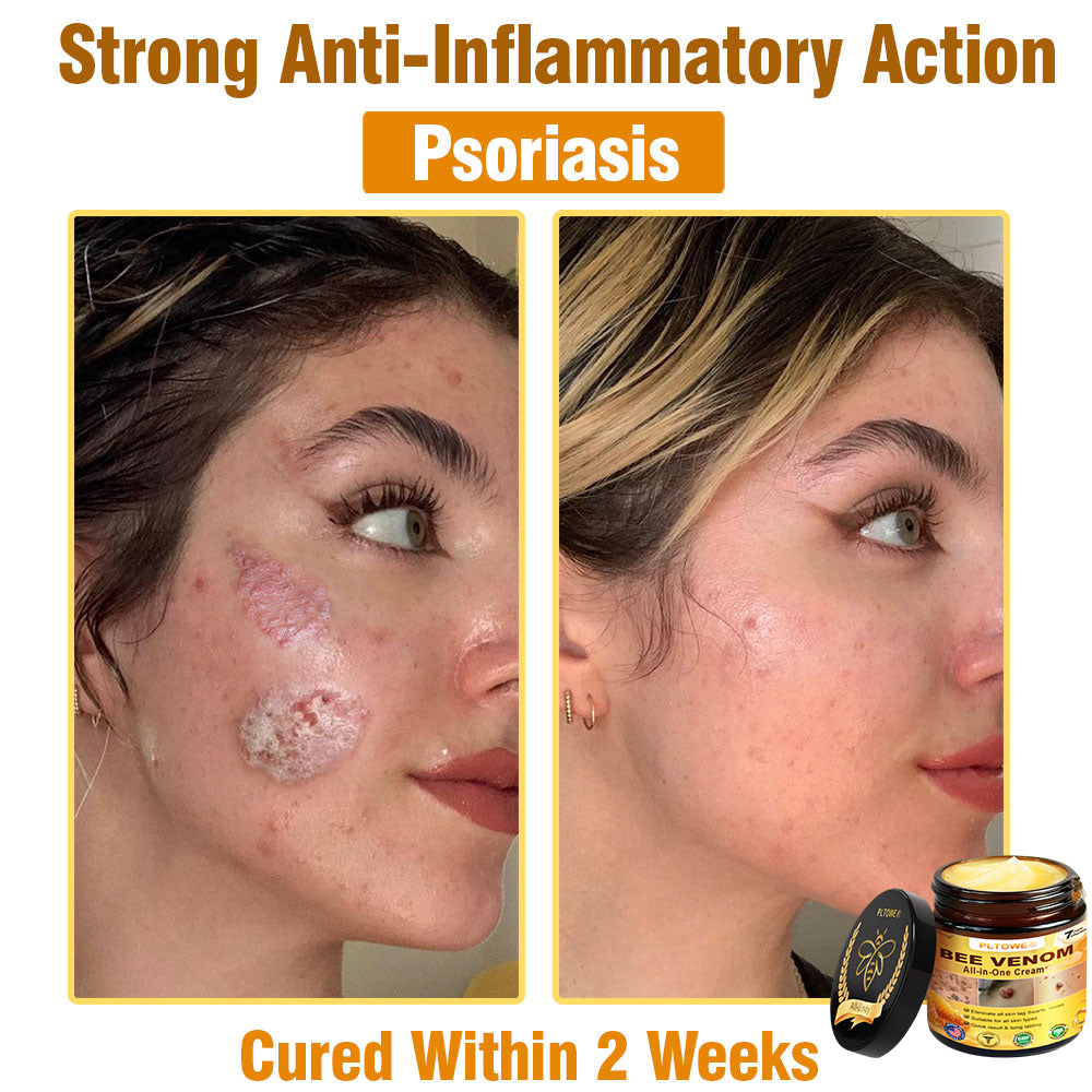 Only 5 jars! Grab an exclusive 50% discount now! Keep your skin youthful and glowing in just 1 to 4 weeks. Don’t miss your chance—this offer won’t come around again until next year. Act fast! 180-day money back guarantee!