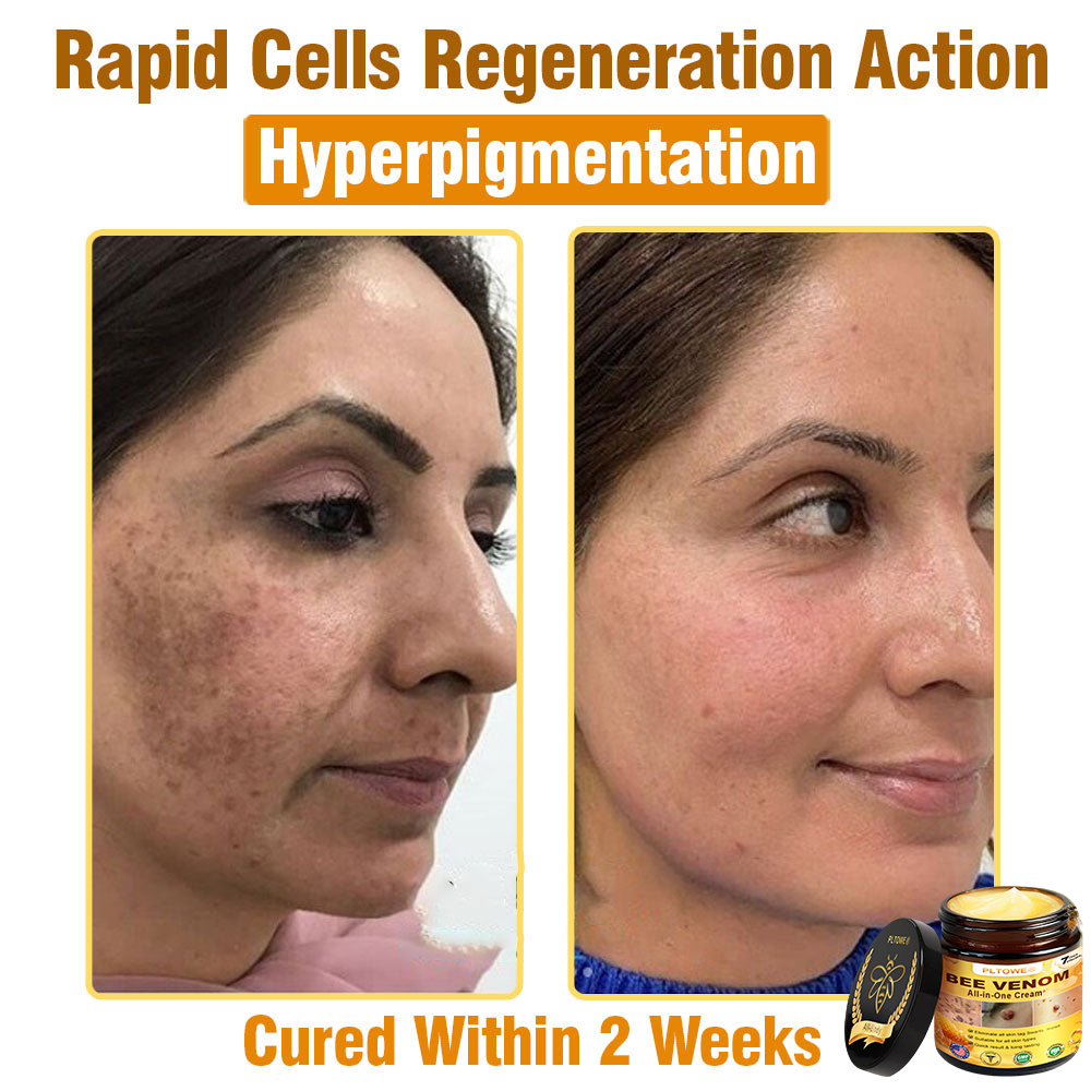 Only 5 jars! Grab an exclusive 50% discount now! Keep your skin youthful and glowing in just 1 to 4 weeks. Don’t miss your chance—this offer won’t come around again until next year. Act fast! 180-day money back guarantee!