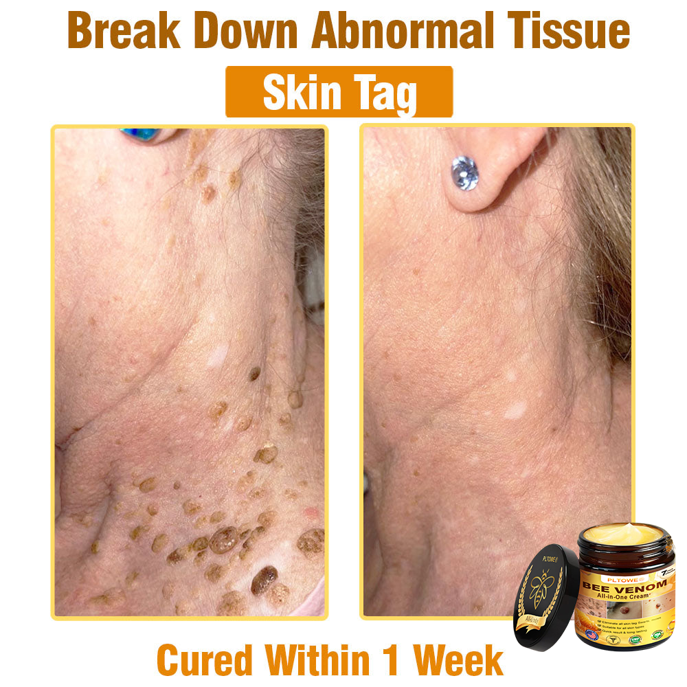 Only 5 jars! Grab an exclusive 50% discount now! Keep your skin youthful and glowing in just 1 to 4 weeks. Don’t miss your chance—this offer won’t come around again until next year. Act fast! 180-day money back guarantee!