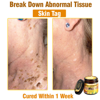 Only 5 jars! Grab an exclusive 50% discount now! Keep your skin youthful and glowing in just 1 to 4 weeks. Don’t miss your chance—this offer won’t come around again until next year. Act fast! 180-day money back guarantee!